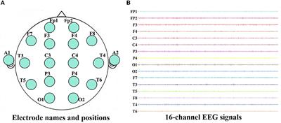 A novel framework of MOPSO-GDM in recognition of Alzheimer's EEG-based functional network